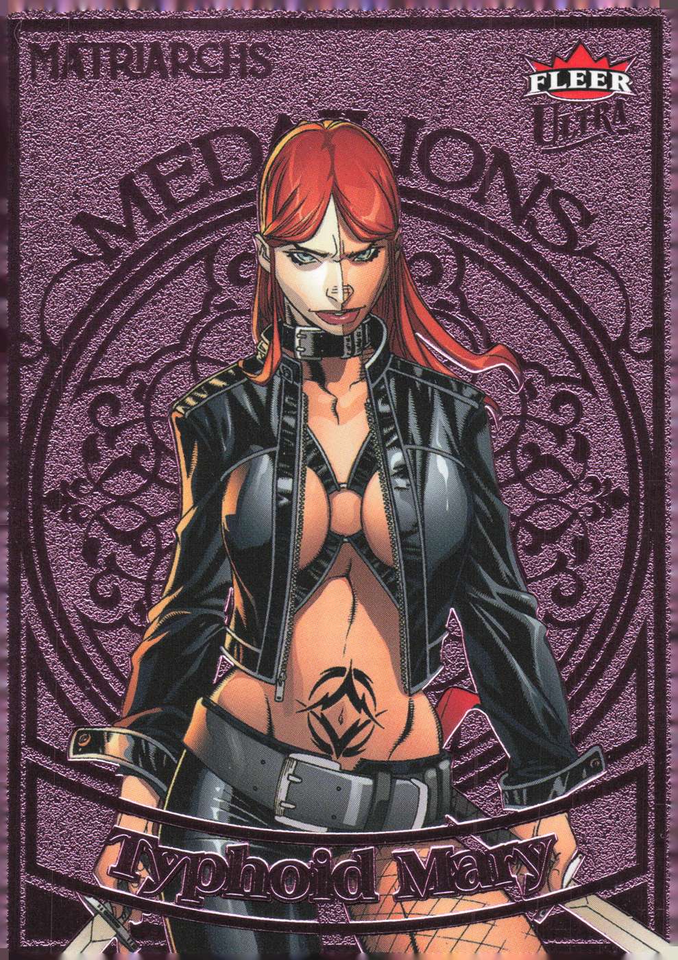 Typhoid Mary